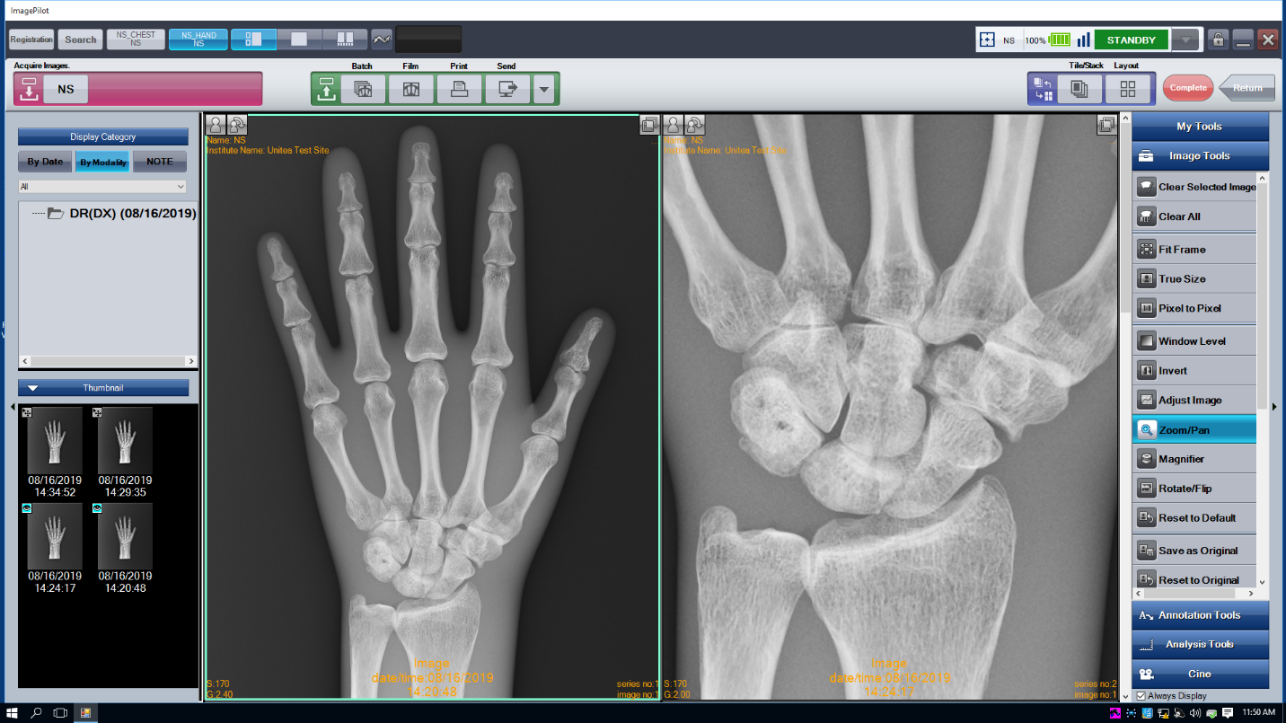 All-in-one console software for small facilities that combines the DR/CR console and Mini-PACS functions. It is applicable for radiography and various imaging needs in hospitals.