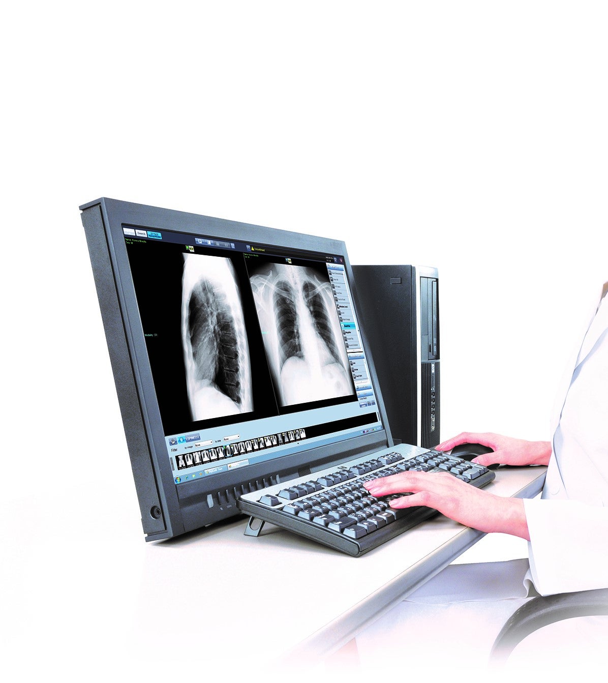 All-in-one console software for small facilities that combines the DR/CR console and Mini-PACS functions. It is applicable for radiography and various imaging needs in hospitals.