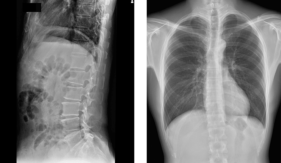 DR/CR console software developed for use by radiologists. It offers multi-functionality, customizability, and user-friendly operation.