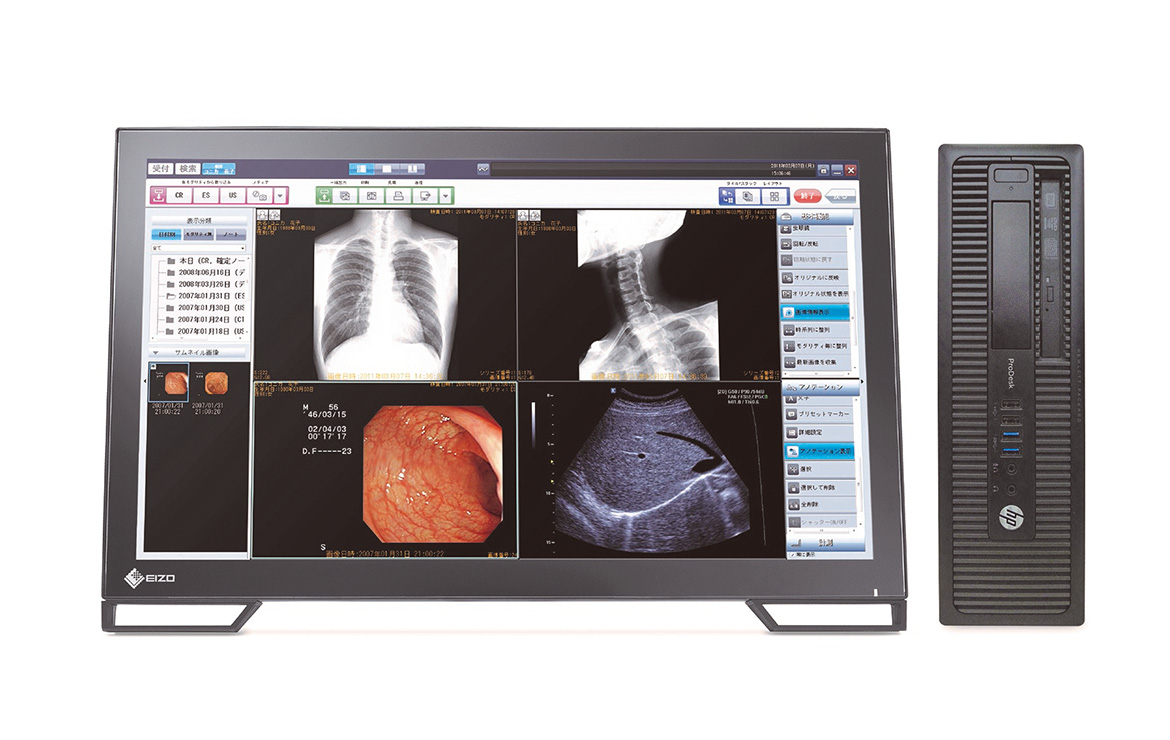 All-in-one console software for small facilities that combines the DR/CR console and Mini-PACS functions. It is applicable for radiography and various imaging needs in hospitals.