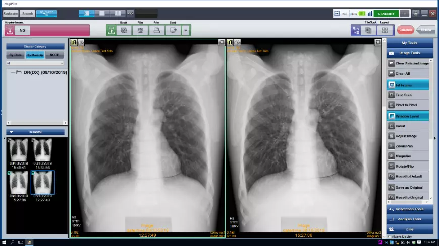 Аппарат цифровой радиографии SKR4000