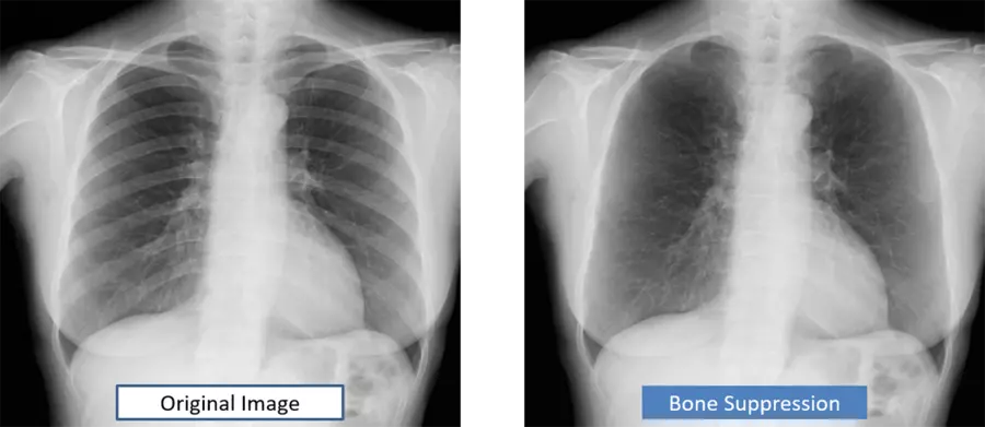 Аппарат цифровой радиографии SKR4000