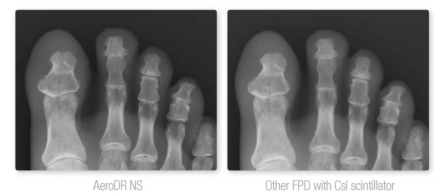Аппарат цифровой радиографии SKR4000